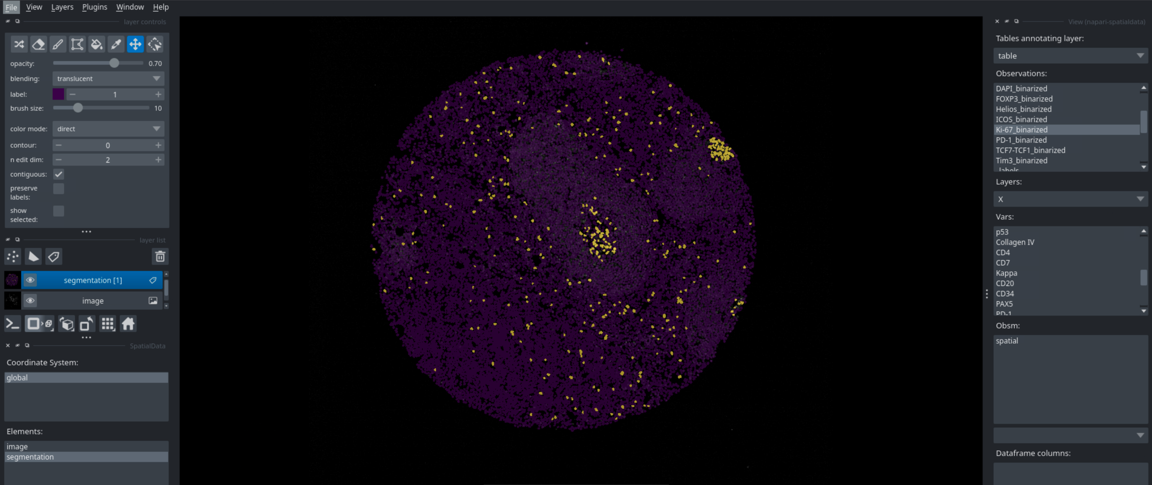 Visualization of a marker binarization with napari