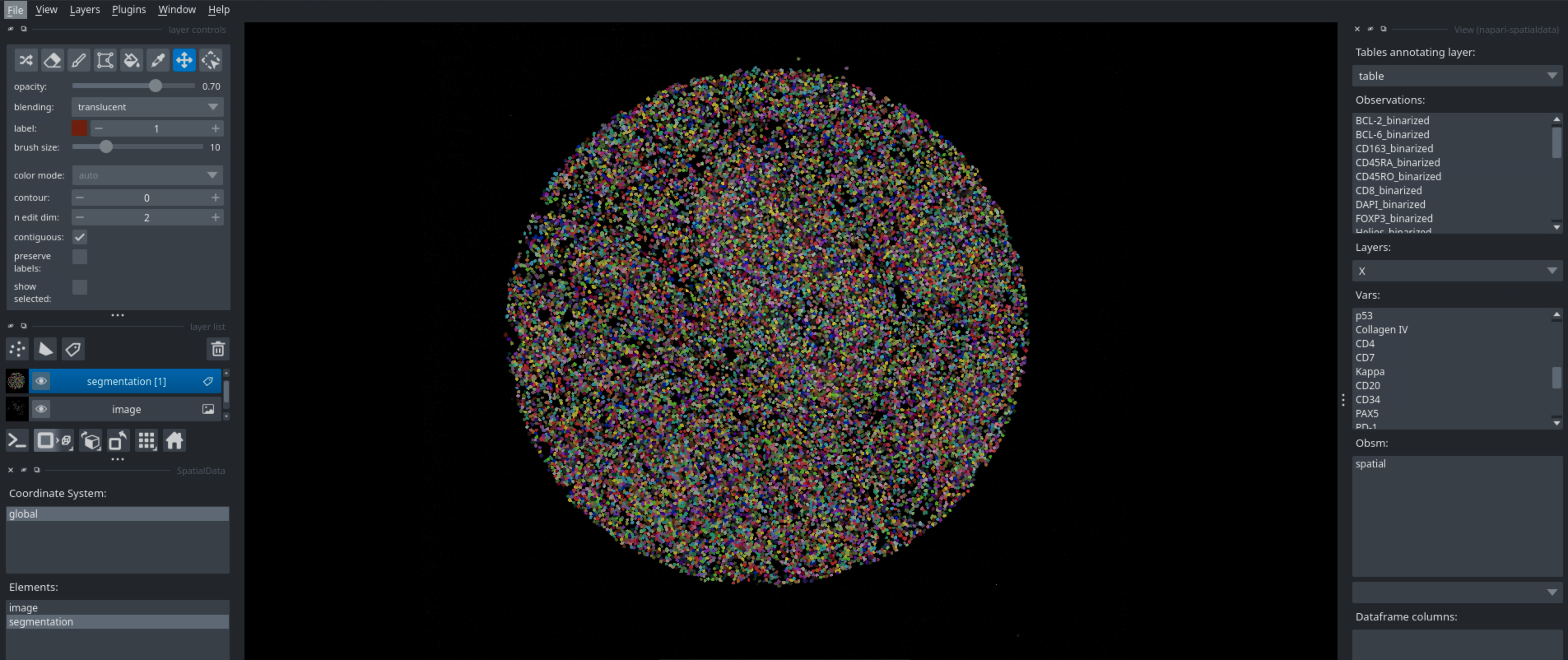 Visualization of a segmentation with napari